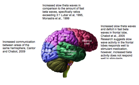 qEEG