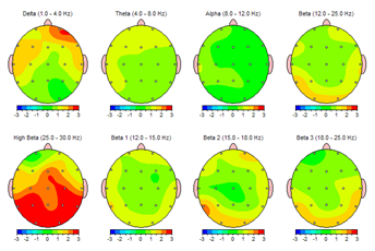 brain maps