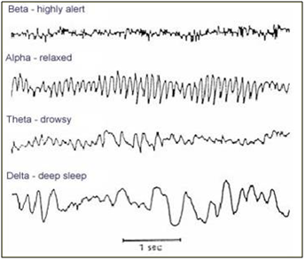 brainwaves